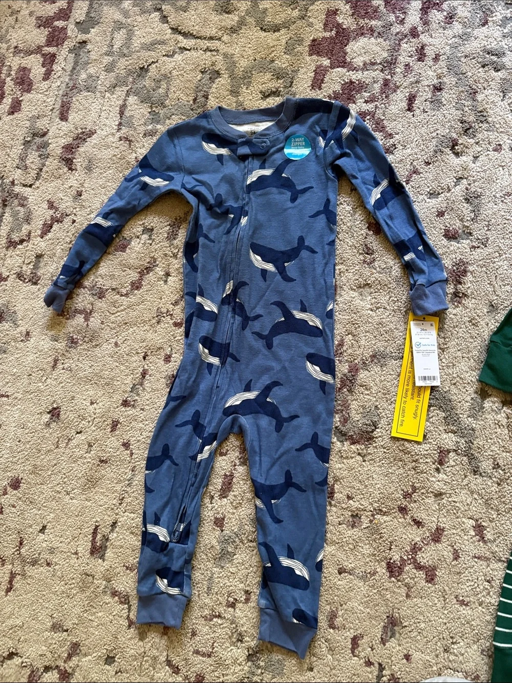 Blue Whale-Print Kids Zipper One-Piece Bodysuit